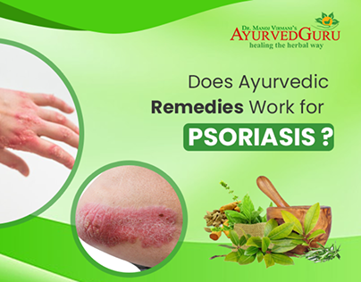 The best ayurvedic doctor for psoriasis treatment