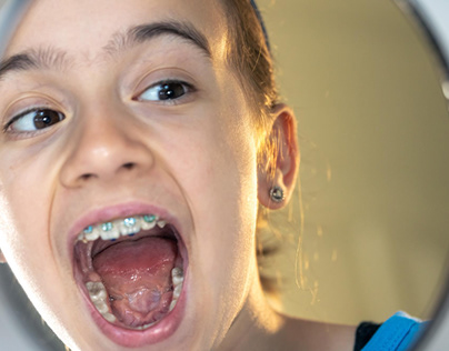 Can orthodontic treatment improve your oral health?