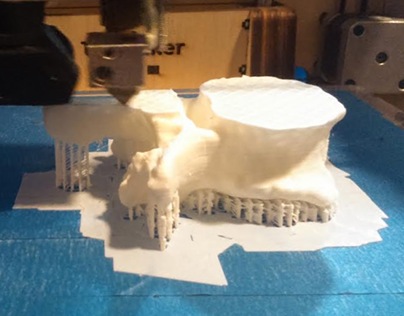 3D Printing (Bone Segmentation)