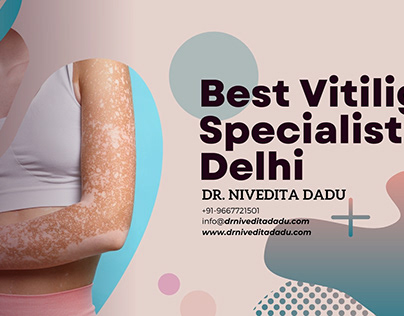 Best Doctor for Vitiligo Treatment in