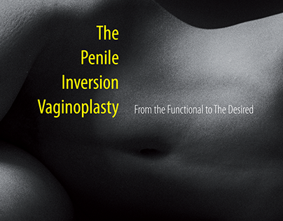 The Penile Inversion Vaginoplasty
