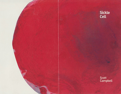 Sickle Cell & Sickle Cell 2: Scott Campbell
