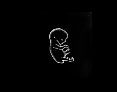 A Micro Motion Graphic Project: 'F' is for Fetus