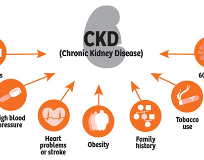 Chronic Kidney Disease - A Common, Manageable Condition