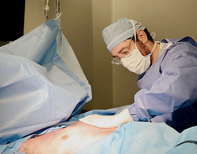 Gynecomastia Surgery Ontario