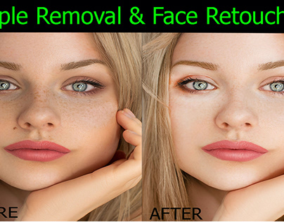 Pimple Removal & Face Retouching