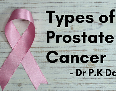 Types of Prostate Cancer