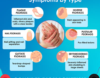 Decoding Psoriasis Symptoms by Type: