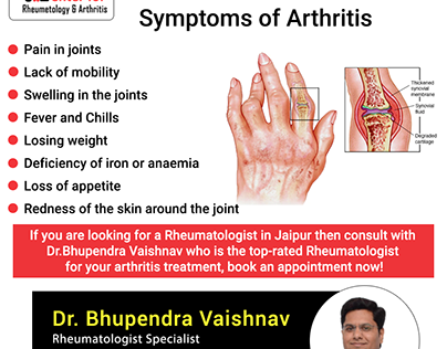 Symptoms of arthritis.