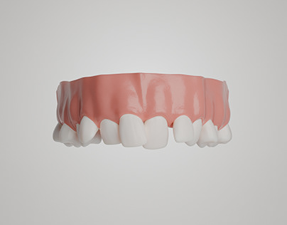 CGI Render for dental aligners