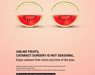 Educational posters about cataract surgery by Alcon