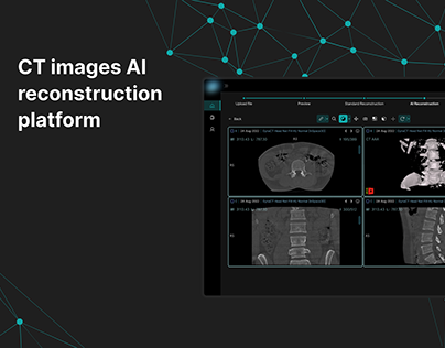 CT images AI reconstruction platform