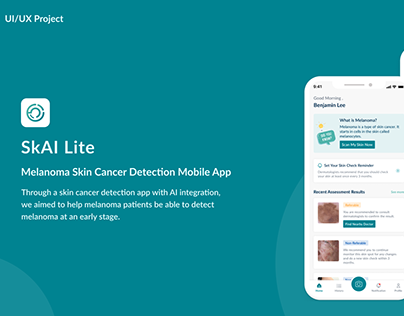 Melanoma Skin Cancer Detection Mobile App UI/UX