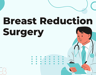 Preparation for Breast Reduction Surgery