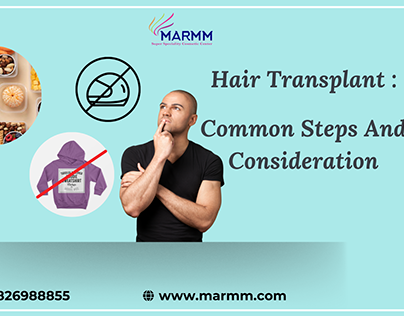 Hair Transplant : Common Steps And Consideration