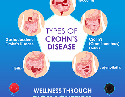 types of crohn's disease