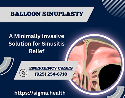 Balloon Sinuplasty: Gentle Relief for Sinusitis