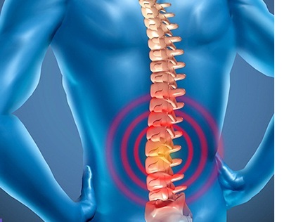 Spinal Stenosis – Symptoms and Treatments
