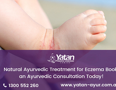 Natural Eczema Treatment for Children in Sydney