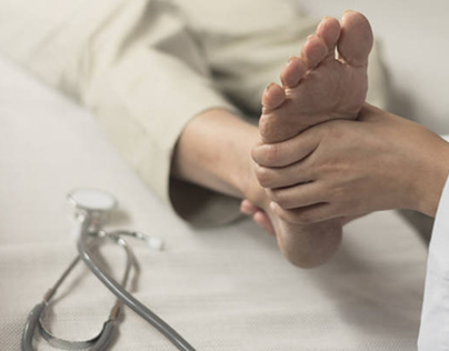 How to Treat Rheumatoid Arthritis in Feet