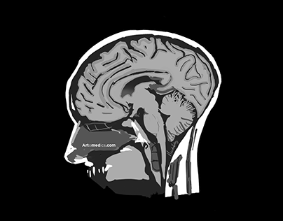 Head MRI digital painting