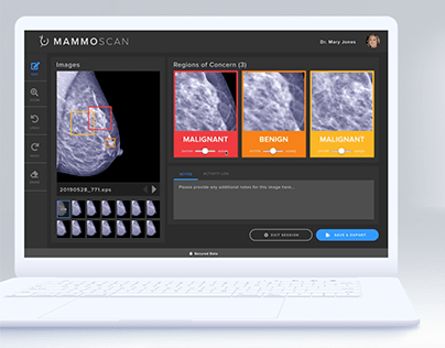 MammoScan: AI enabled Mammogram Toolkit