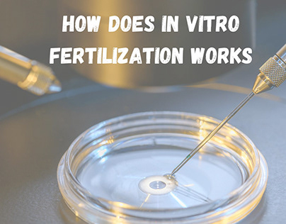 How Does In Vitro Fertilisation (IVF) Works?