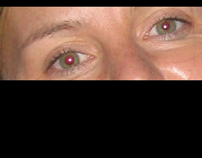 Red eye removal