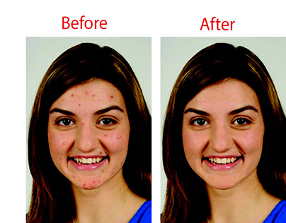 Face spot removal photo