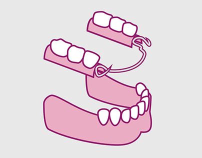 Problème de dents : quelle prothèse dentaire ?