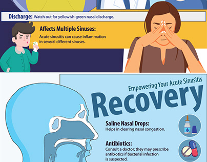 Acute Sinusitis: Symptoms, Treatment & Prevention Tips