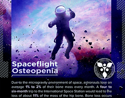 Spaceflight Osteopenia