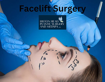 Get The Very Useful Facelift Surgery at Fair Cost