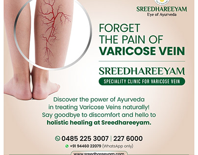 Ayurveda Treatment for Varicose Vein