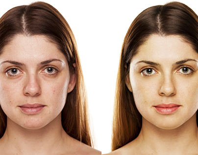 Natural Look. Model Retouch - Before/After