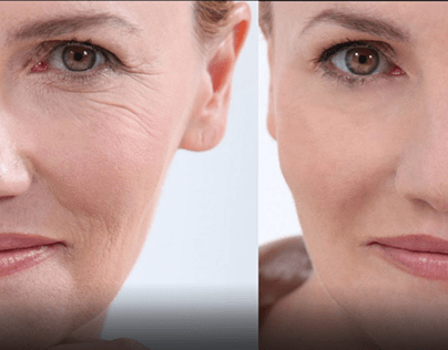 Removing Face Wrinkles With Photoshop