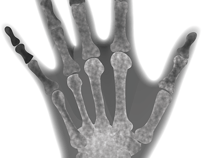 X-Ray Hand (2016)