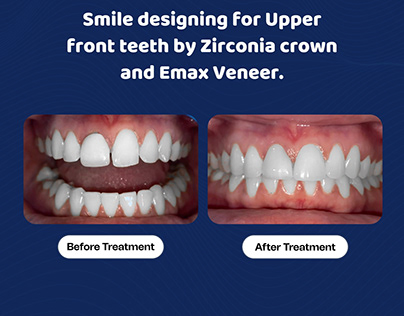 Transform Smile Top-rated Dental Clinic in Seegehalli