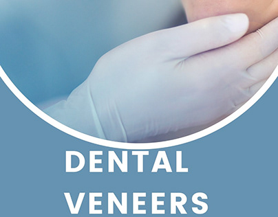 Dental Veneers London