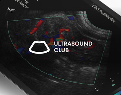 Ultrasound Club