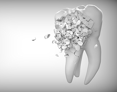 orthodontic 3D cliparts