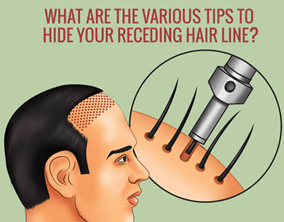 Tips to Hide your Receding Hairline