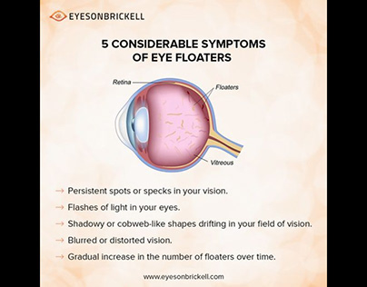 Symptoms of Eye Floaters | Eyes on Brickell