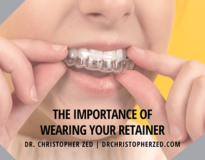 The Importance of Wearing Your Retainer