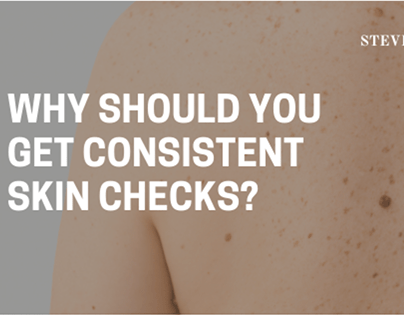 Why Should You Get Consistent Skin Checks?
