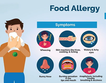 Understanding Food Allergy