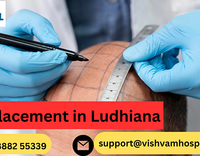 hair replacement in ludhiana