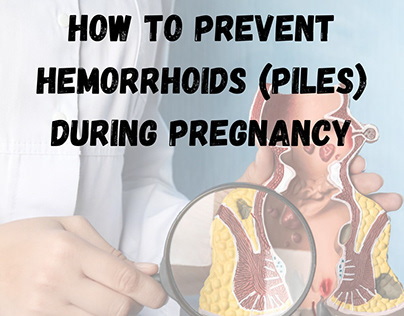 How to Prevent Hemorrhoids (Piles) During Pregnancy