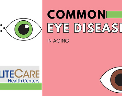 Common Eye Diseases in Aging