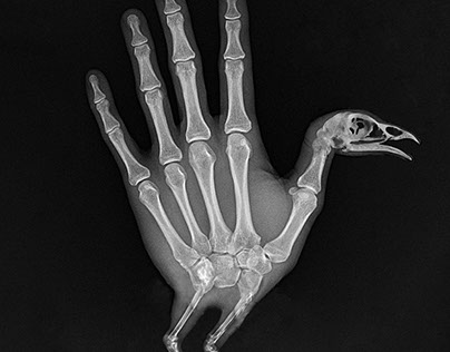 X-Ray Hand Turkey - ACT 3